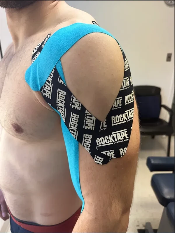 Chiropractic Rockville MD Patient with Kinesio Tape A patient's shoulder with KT Tape applied to support healthy range of movement and muscle support